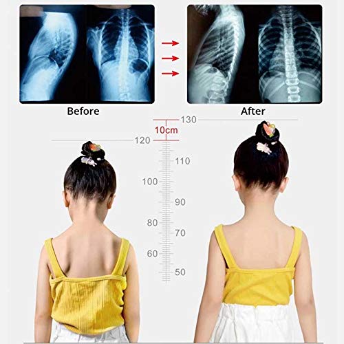Intelligent Posture Corrector Back Posture Trainer Clavicle Spine Shoulder Correction Smart Tips Adjustable Length Back Support (Color : Pink) (White)