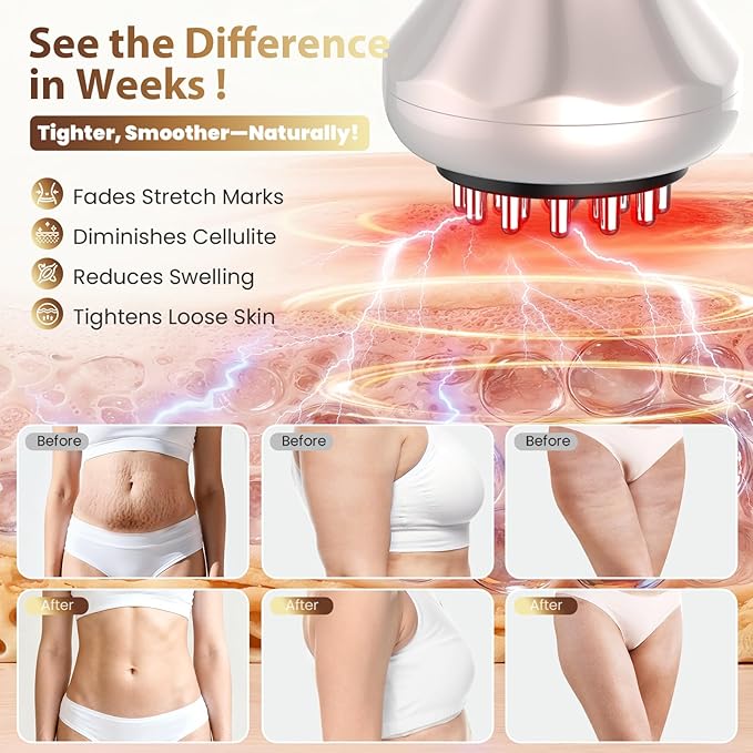 Lymphatic Drainage Massager, Anti Cellulite Massage Tool For Belly & Thigh Stretch Marks & Cellulite Reduction, Handheld Massage tools for Sciatica Nerve, shoulder, Hip, Muscle, Low Back Pain Relief